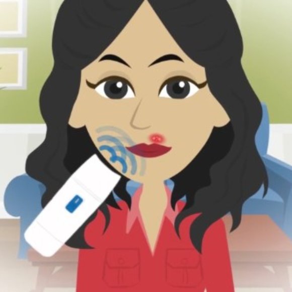 Virulite The Only FDA Approved Cold Sore Treatment Device - Picture 6 of 17